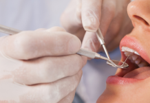 Este tratamentul de canal o urgență medicală? Învață să recunoști semnele unei probleme serioase